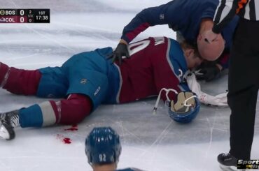 Nathan MacKinnon bloodied after a hit by Taylor Hall