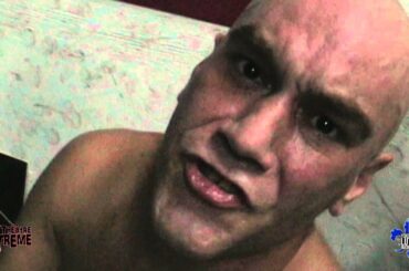 CARL XL post match message to RYAN ROGAN