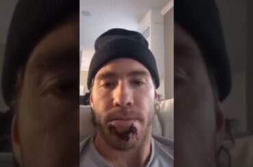 Mike Hoffman: Cross-Check to FACE❗😱(you won't believe the penalty) #shorts #hockey #mikehoffman