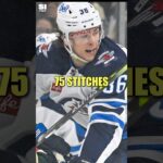 Jets forward Morgan Barron gets 75 stitches and goes BACK IN 😳