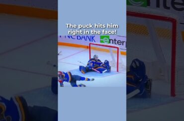 Tucker Takes Puck to FACE❗(see the aftermath)😱 #shorts #hockey #tylertucker