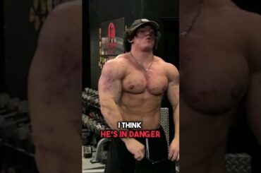 Sam Sulek Is Endangering Himself