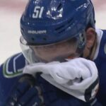 Canucks' Stecher needs repairs after taking a puck to the face