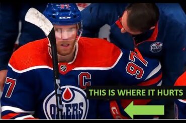 CONNOR MCDAVID Injury - Dr. Wilson reacts