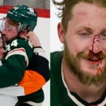 NHL Fights But They Get Increasingly More Violent (Part 1)