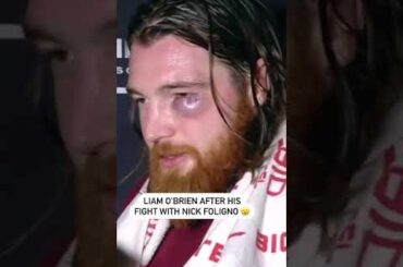 Liam O’Brien has quite the shiner after his fight with Nick Foligno 😳