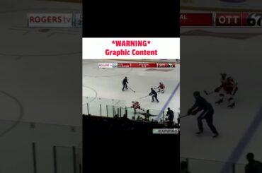 Clean hockey hit quickly turns bad #shorts