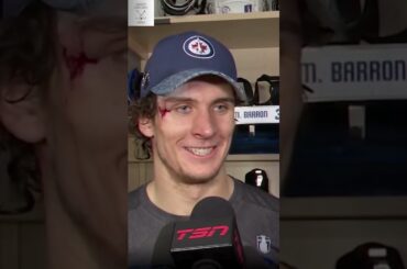 🦸‍♂️Morgan Barron's Resilience: Skateblade to Face, Injury, and Triumphant Return!🏒#shorts#nhl