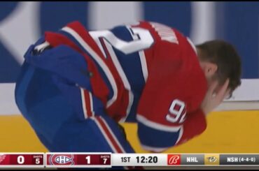 Jonathan Drouin Hit In The Face With Puck
