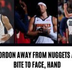 Aaron Gordon away from Nuggets after dog bite to face hand | NY Sports News