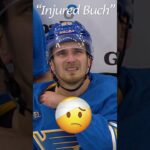 RBF (Resting Buch Face)