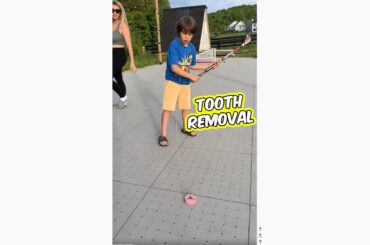 How Canadian kids remove teeth