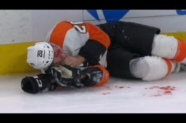 Gerald Mayhew badly injured after going face first into the boards