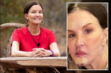 Chicago Blackhawks Suffer Major Setback: Jason Dickinson's Season-Ending Injury