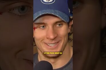 Morgan Barron said this after receiving 75 stitches beside his eye and returning to the game. 😳