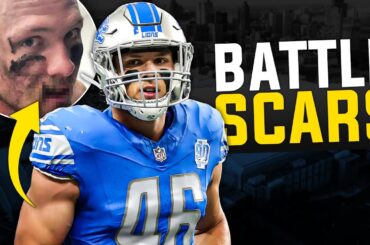 Detroit Lions LB Jack Campbell Suffers GRUESOME Lip Injury?!