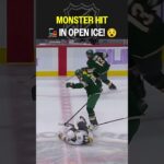 That's gotta HERT 😵‍💫