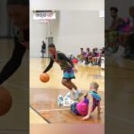 He BROKE His Ankles 4 TIMES In ONE Game 😱