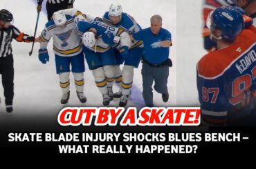 Blues Forward Cut by Skate – Fans Fear Season-Ending Injury!