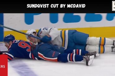 Sundqvist cut by skate - Tough Call Review