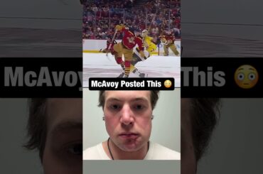 Charlie McAvoy proves his injury 😳🤕 #hockey #nhl