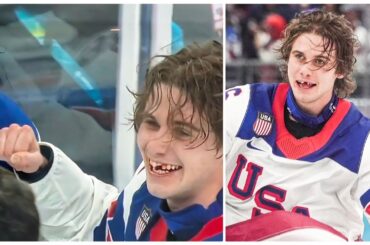 Jack Hughes loses his teeth During USA vs Canada Ice Hockey Olympics Final & Scored Goal vs Canada