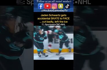 Seattle Kraken Jaden Schwartz gets kicked in face with skate, bleeding leaves game #NHL #Hockey #fyp