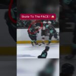 Skate to the Face?! Schwartz's VISOR Saves Him 😱🏒 #Shorts