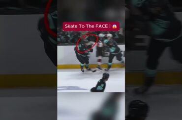 Skate to the Face?! Schwartz's VISOR Saves Him 😱🏒 #Shorts