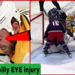 🚨 Ryan O'Reilly Eye Injury Update! 😱 Predators Star Hit by Stick vs Blue Jackets