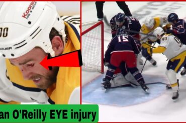 🚨 Ryan O'Reilly Eye Injury Update! 😱 Predators Star Hit by Stick vs Blue Jackets