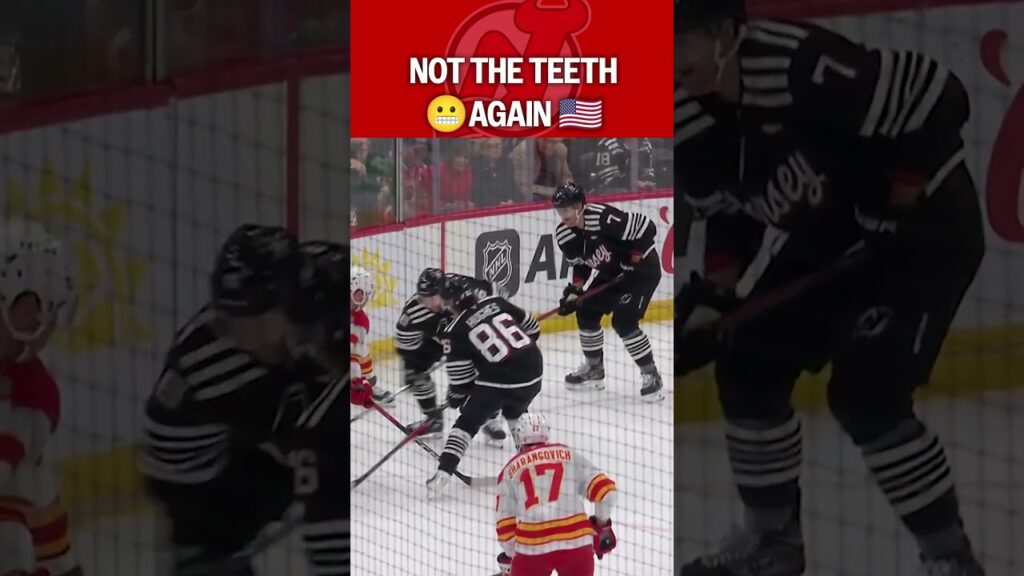 Olympic Teeth Flashbacks for Hughes 😬