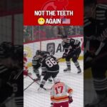 Olympic Teeth Flashbacks for Hughes 😬