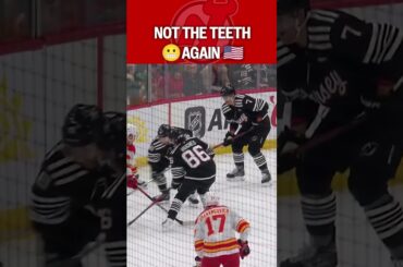 Olympic Teeth Flashbacks for Hughes 😬