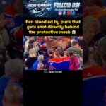 Fan hit, bloodied by puck at Edmonton #Oilers/ Vegas #GoldenKnights #NHL #Hockey #foryou #fyp