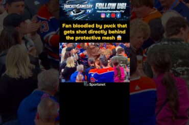 Fan hit, bloodied by puck at Edmonton #Oilers/ Vegas #GoldenKnights #NHL #Hockey #foryou #fyp
