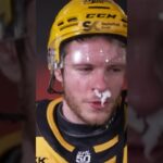 Rickard Hugg om att få Oskari Laaksonen armbåge i ansiktet (Skellefteå AIK Luleå HF i SHL) (#Shorts)