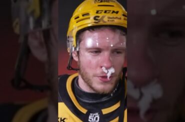 Rickard Hugg om att få Oskari Laaksonen armbåge i ansiktet (Skellefteå AIK Luleå HF i SHL) (#Shorts)