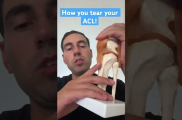 How you tear your acl ! #shorts #acltear